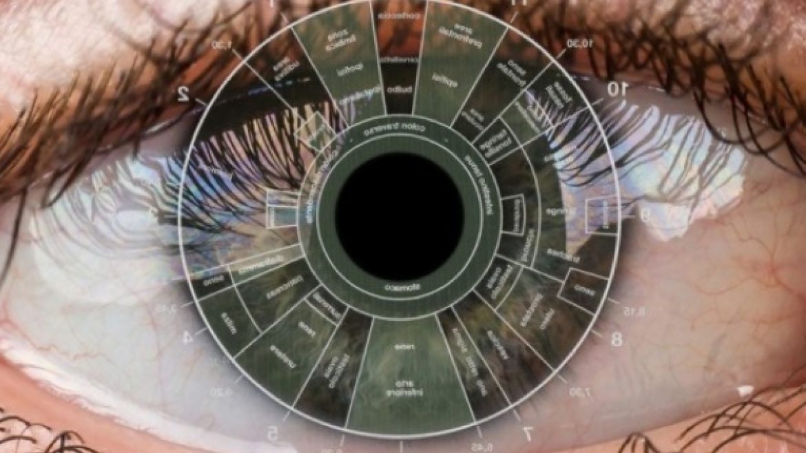 Iridiología